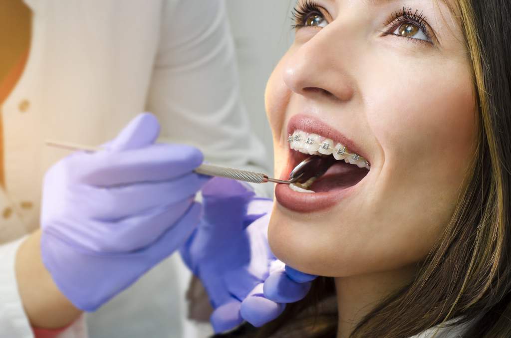 6 неочевидных признаков, что пора навестить ортодонта