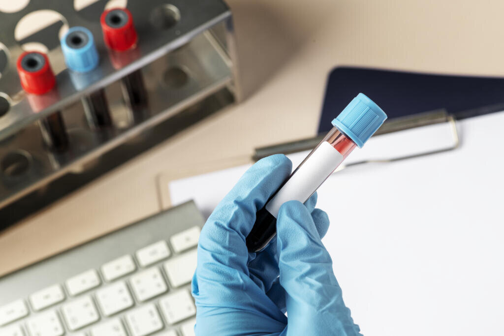 Surgeon holding a blood test Журналист